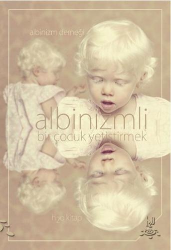 Kurye Kitabevi - Albinizmli Bir Çocuk Yetiştirmek
