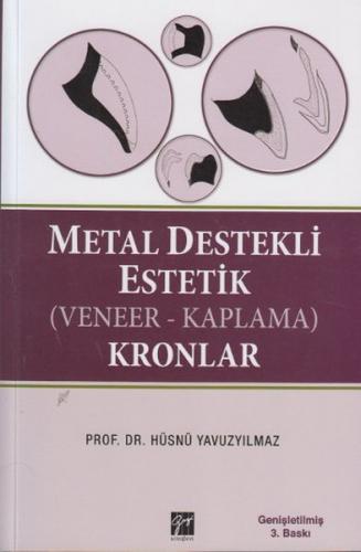 Kurye Kitabevi - Metal Destekli Estetik Veneer Kaplama Kronlar