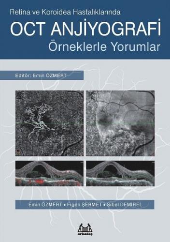 Retina ve Koroidea Hastalıklarında OCT Anjiyografi - Örneklerle Yorumlar